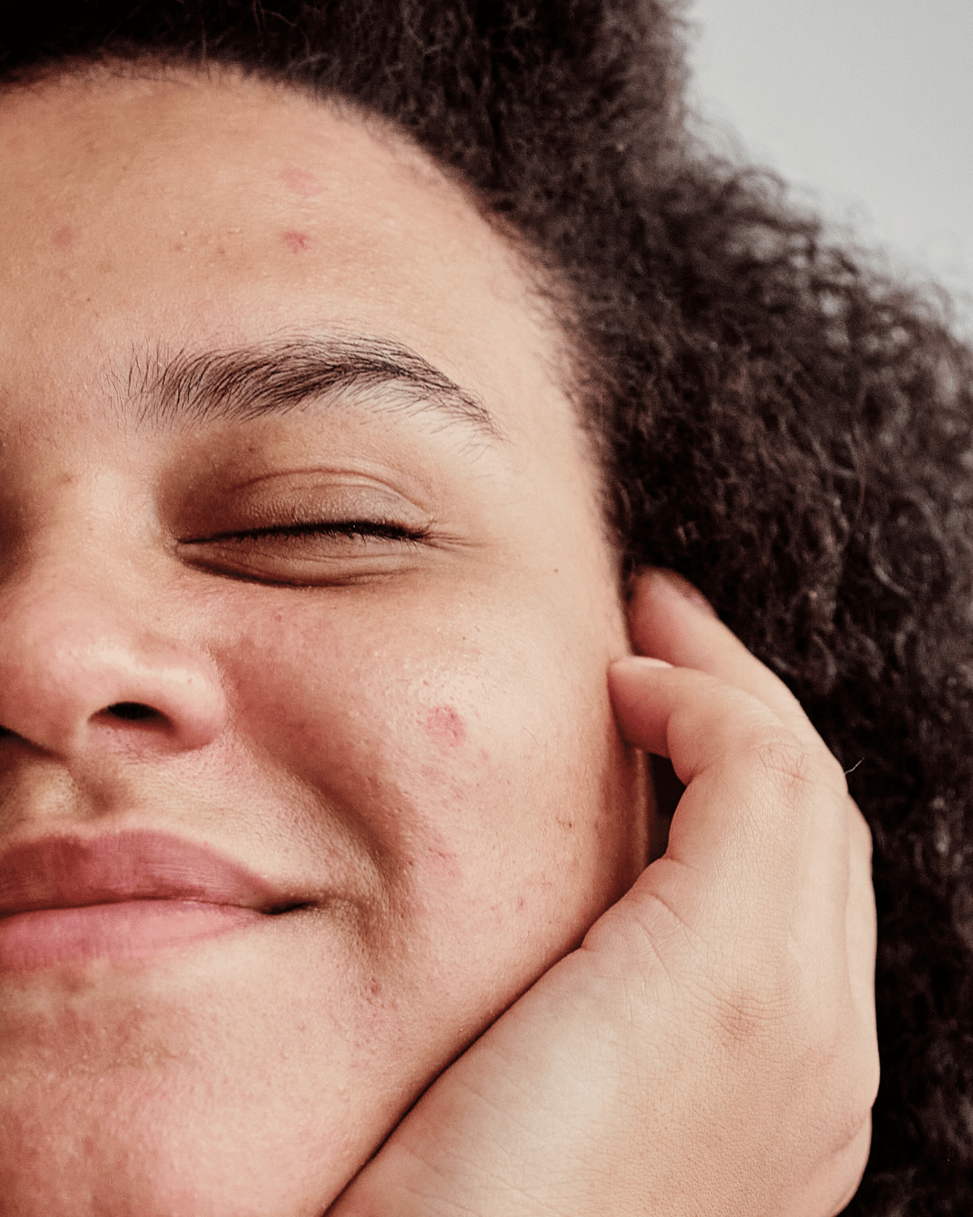 Sensitive Skin
